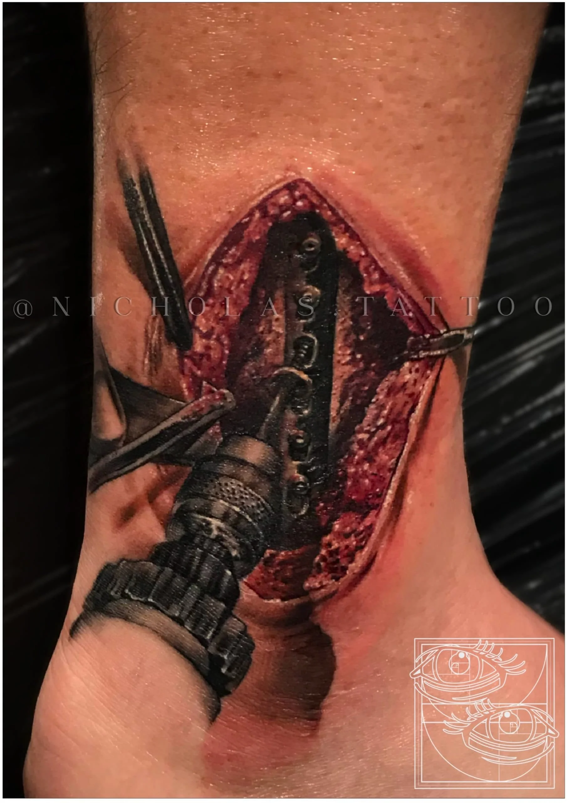 Surgery Tattoo